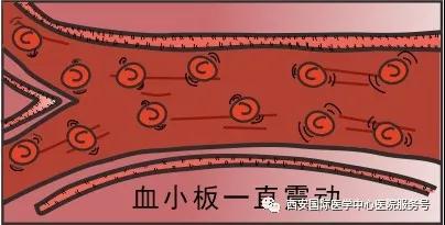 血小板是正常值的三倍？專家提醒小心血栓和出血！