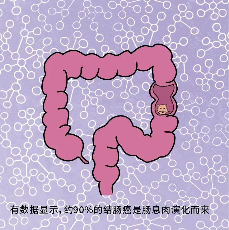 奪走“黑豹”生命的結(jié)腸癌，到底什么來頭？