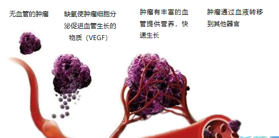 晚期腫瘤為什么會(huì)復(fù)發(fā)轉(zhuǎn)移？