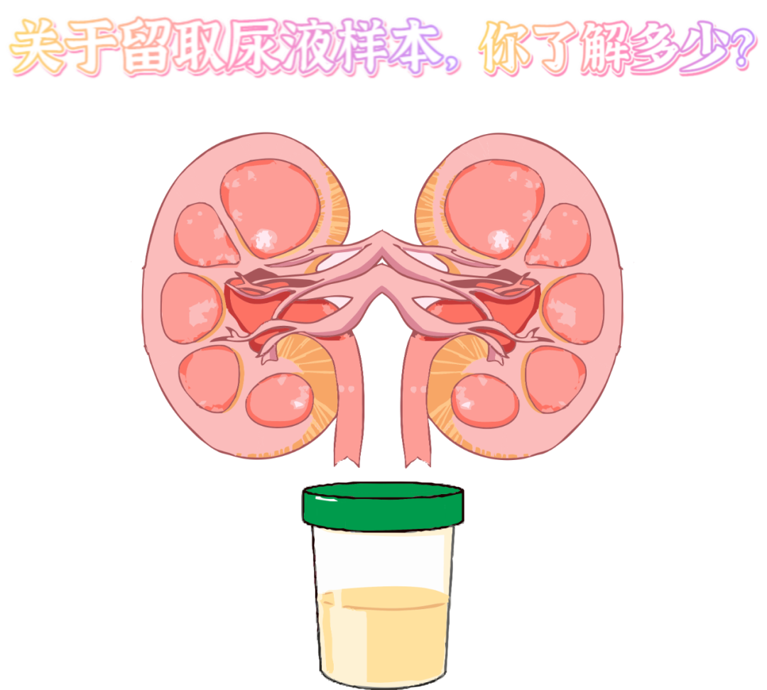 做尿檢，不得不說(shuō)的注意事項(xiàng)！