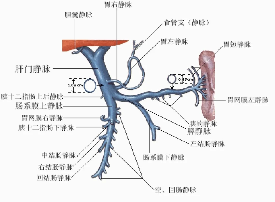 反復(fù)嘔血、黑便怎么辦？TIPS手術(shù)能解決