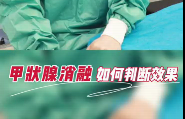 甲狀腺消融如何判斷效果？