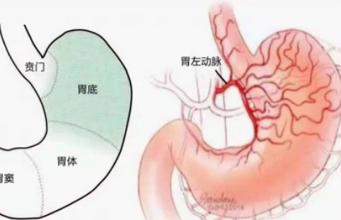 不開刀不吃藥不餓肚子，微創(chuàng)介入減肥靠譜嗎？