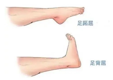 扭胯小連步、動(dòng)感搖花手……“科目三”雖火，運(yùn)動(dòng)損傷也要防！